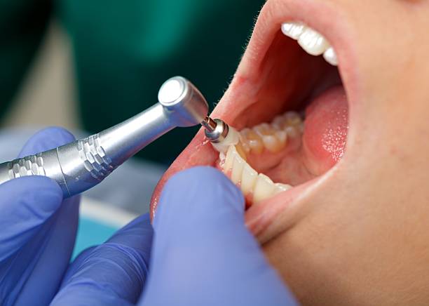 Best Tooth Extraction  in La Honda, CA